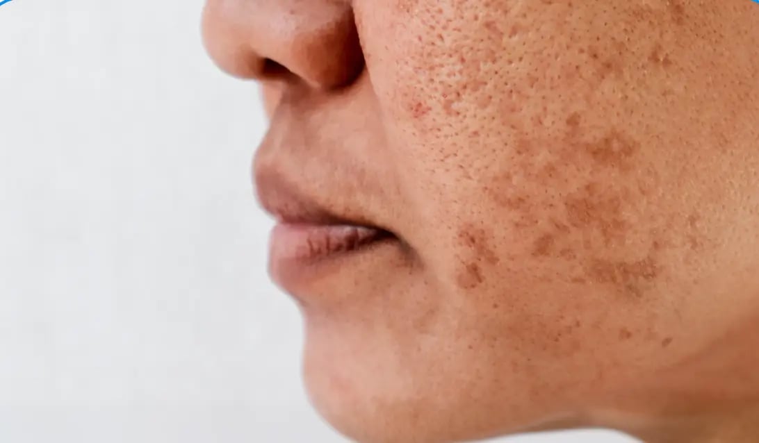 Woman noticing brighter skin in mirror