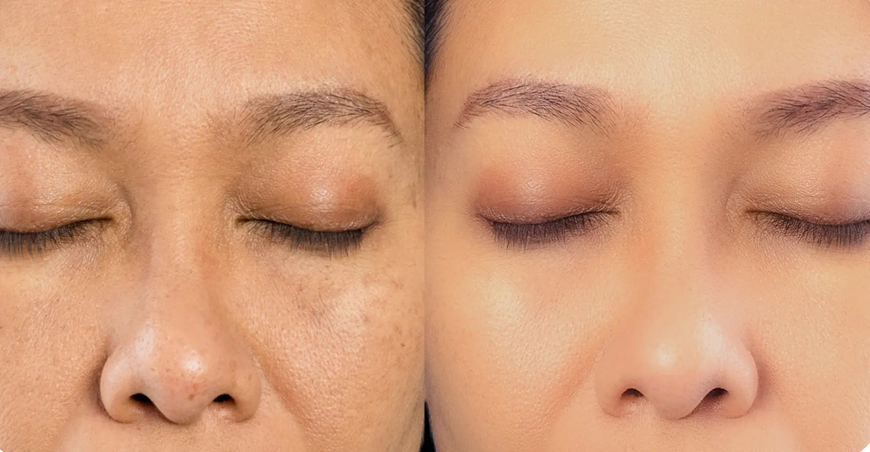 Clear, bright, even-toned skin close-up